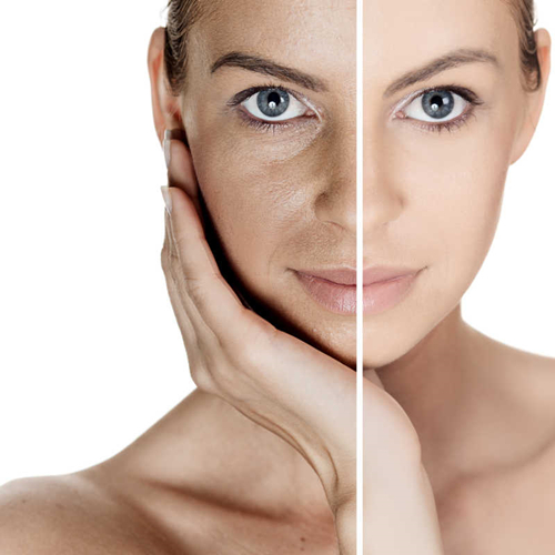 护肤2年和不护肤的区别，护肤与不护肤的区别图