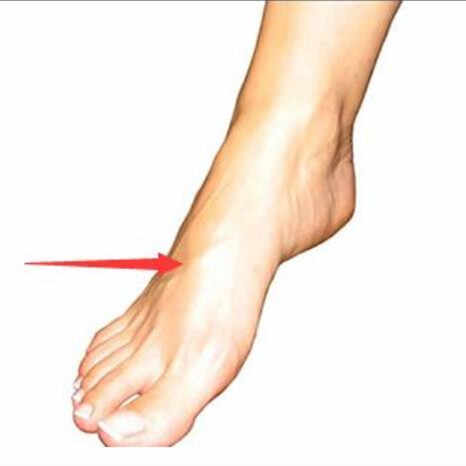 女人长期踮脚的好处，什么人不适合踮脚尖