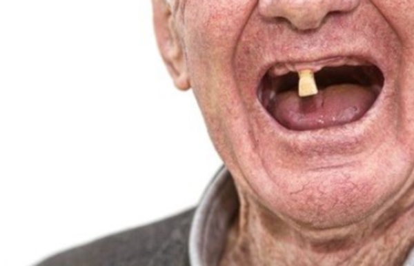 掉牙早的人寿命长吗，掉牙太早会影响寿命吗