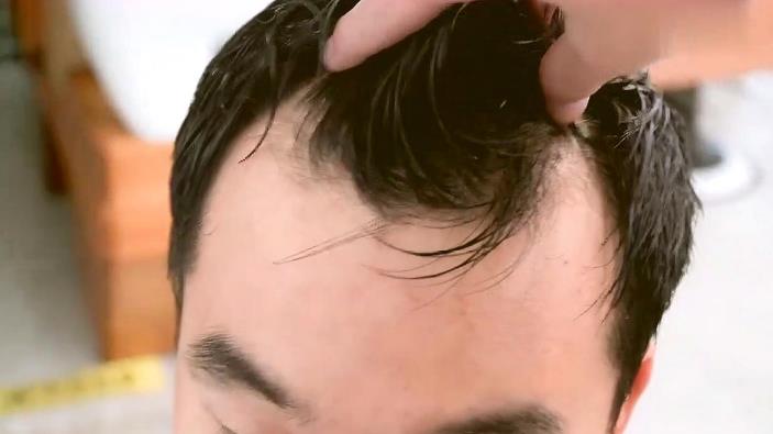 为什么不建议戴假发，男戴假发容易掉下来吗