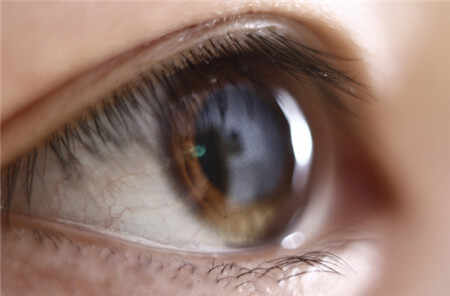 为什么眼黄不可深交，眼珠子黄的人不可深交吗