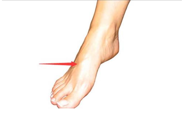 女人长期踮脚的好处，什么人不适合踮脚尖