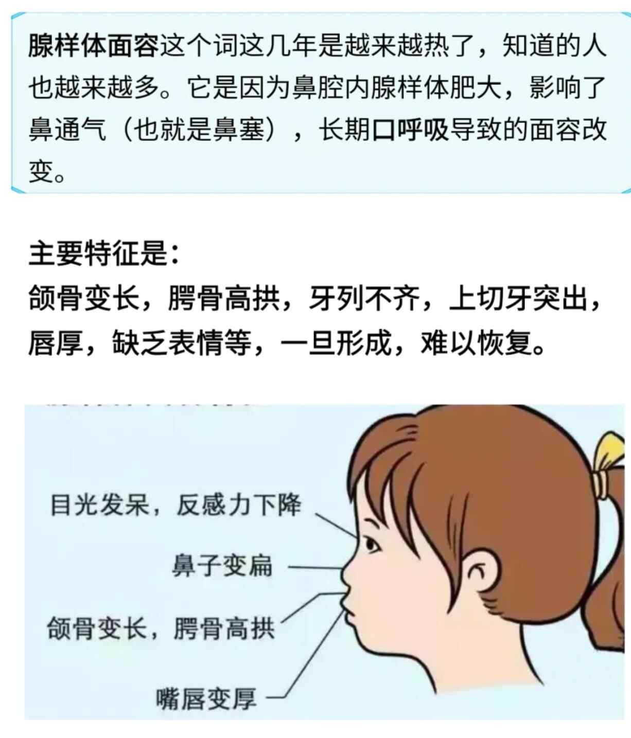 腺样体面容图片对比图，腺样体面容图片